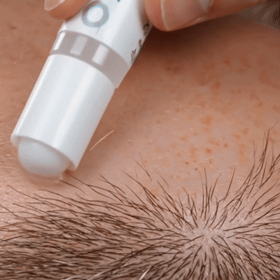 Deep Absorption Technology