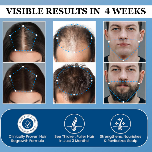 rootswell™ Advanced Hair Growth System