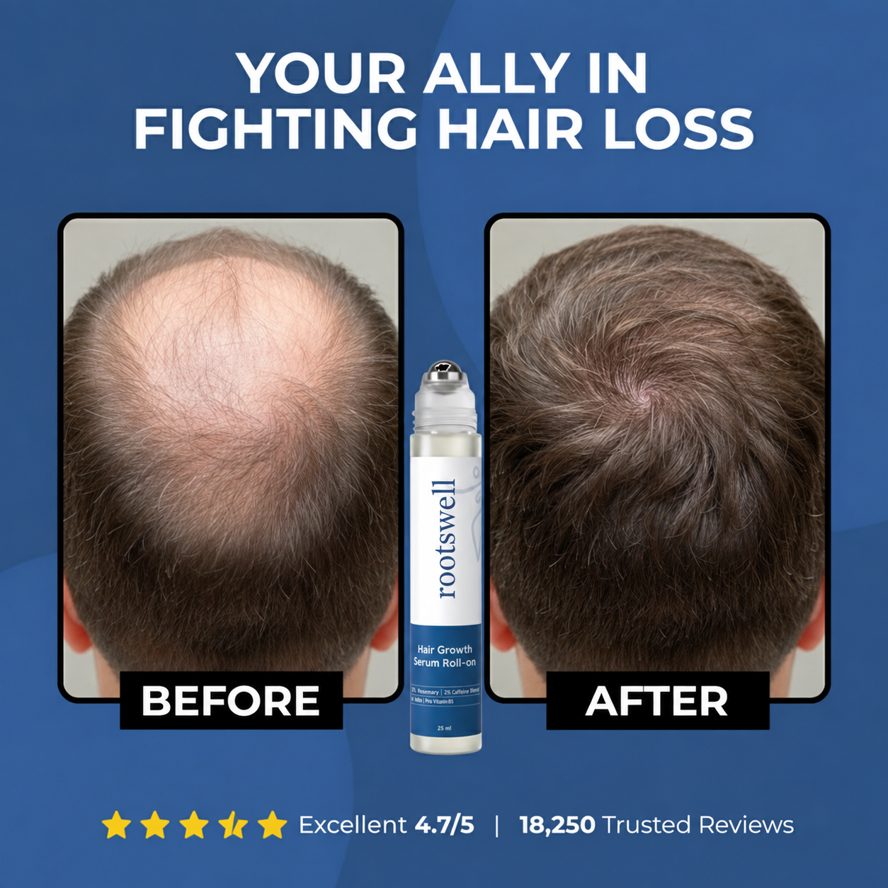 rootswell™ Advanced Hair Growth System